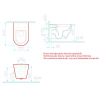 Комплект унитаза с инсталляцией Vitra Sanibelle 9878B003-7200 с сиденьем Микролифт и клавишей смыва Хром глянцевый — фото 9, Комплекты унитаз + инсталляция